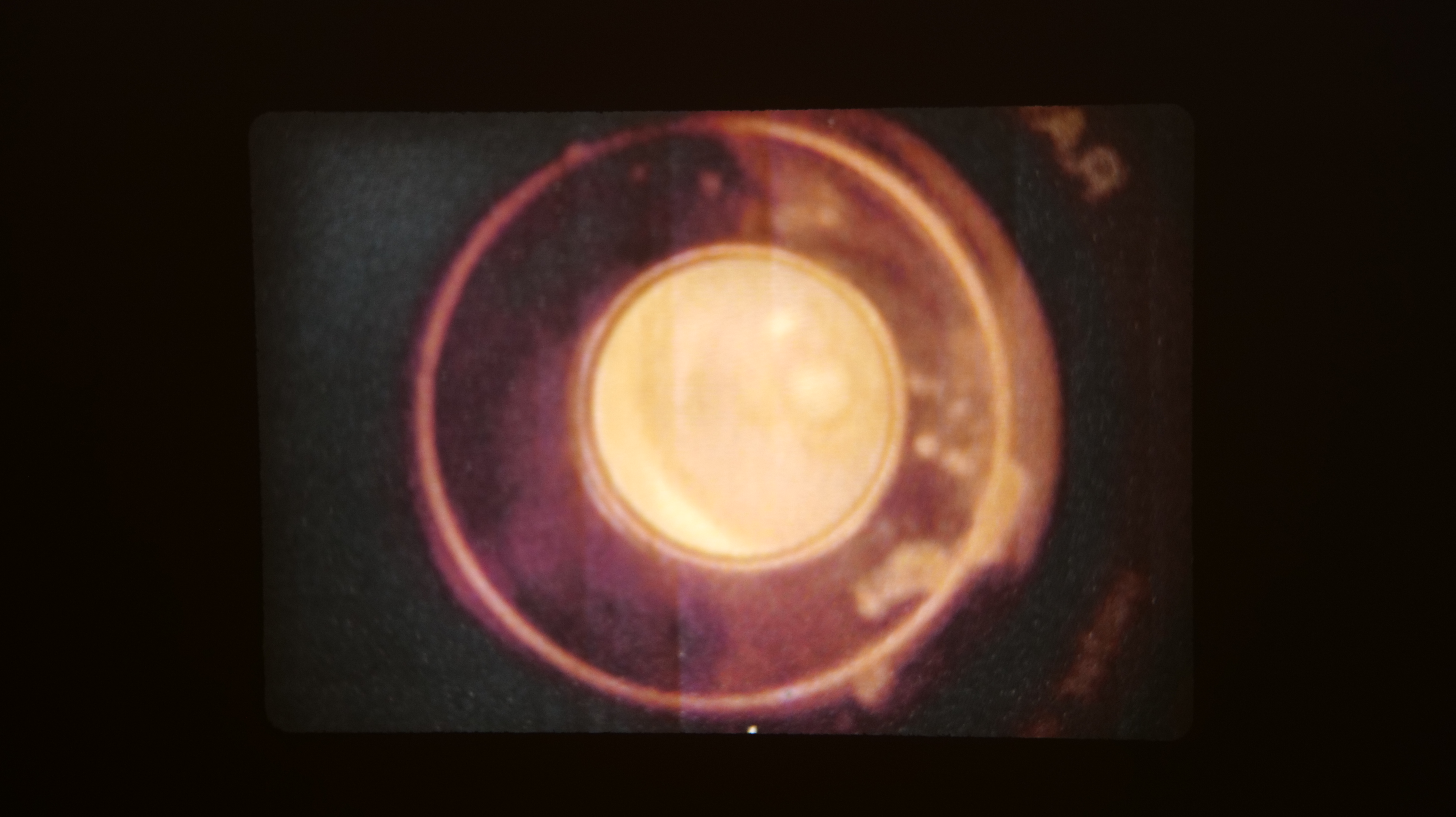 The Eye in the Image Is Blind photo 2